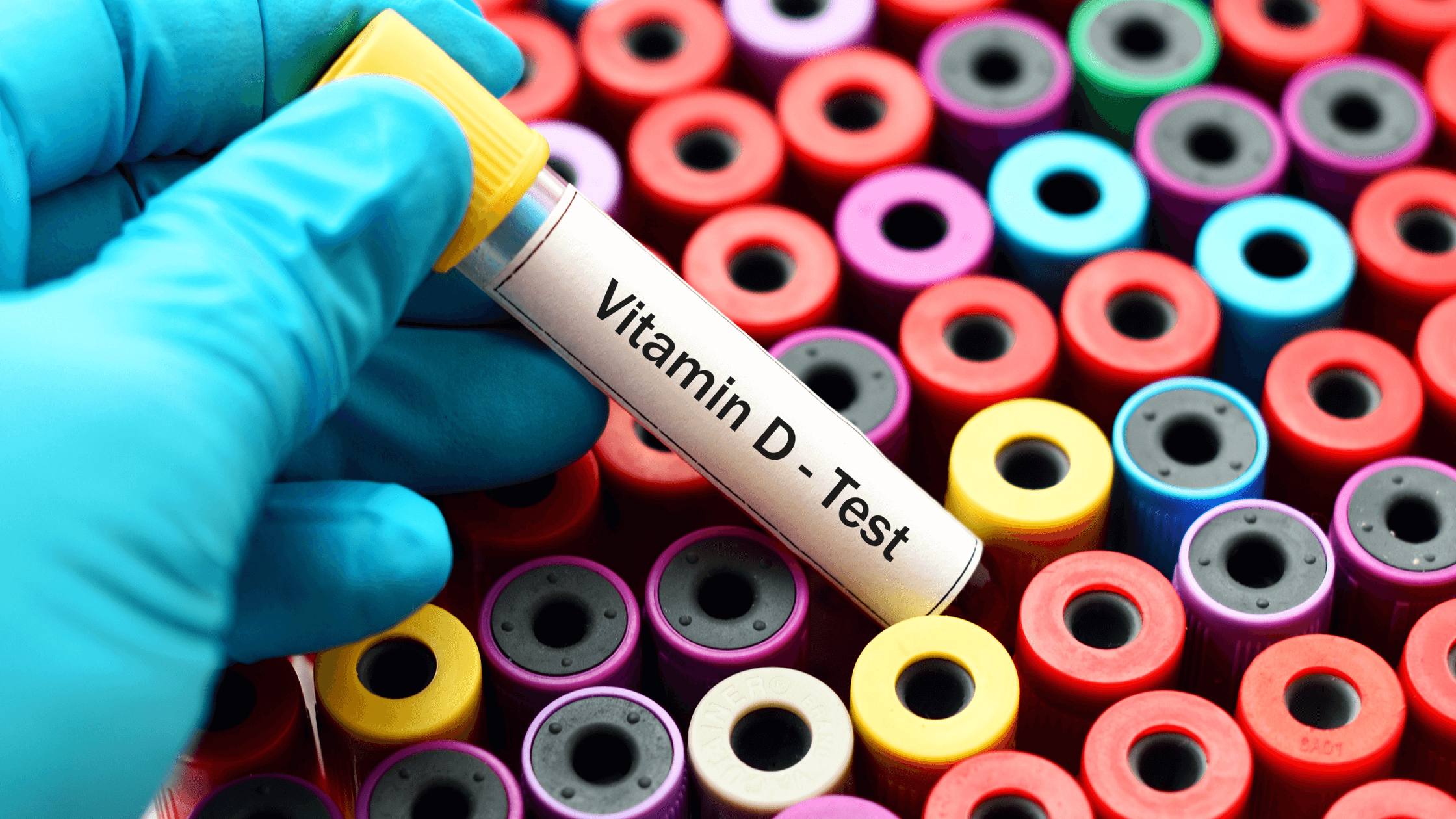 Should You Check Your Vitamin D Levels?