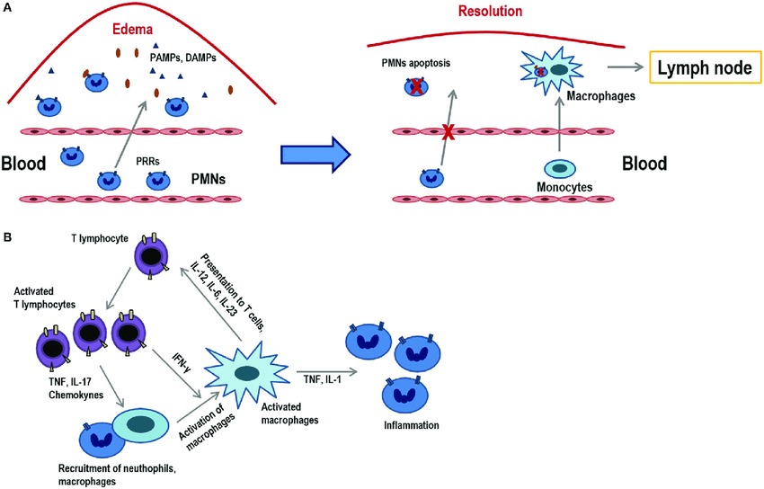 Acute And Chronic Inflammation