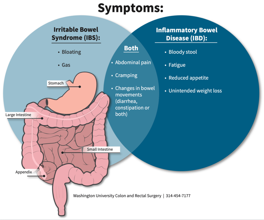 Infographic showing the symptoms of Ibd and Ibs.